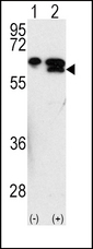 Western blot of MMP3 (arrow) using rabbit polyclonal MMP3 Antibody. 293 cell lysates (2 ug/lane) either nontransfected (Lane 1) or transiently transfected with the MMP3 gene (Lane 2) (Origene Technologies).