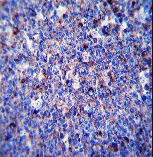 MMP3 Antibody immunohistochemistry of formalin-fixed and paraffin-embedded human tonsil tissue followed by peroxidase-conjugated secondary antibody and DAB staining.