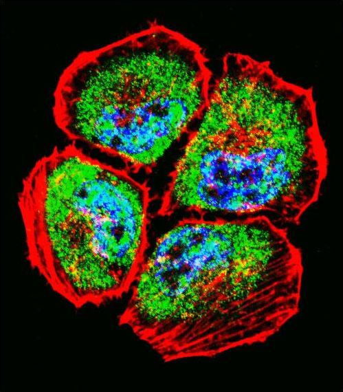 Confocal immunofluorescent of MMP3 Antibody with NCI-H460 cell followed by Alexa Fluor 488-conjugated goat anti-rabbit lgG (green). Actin filaments have been labeled with Alexa Fluor 555 phalloidin (red). DAPI was used to stain the cell nuclear (blue).