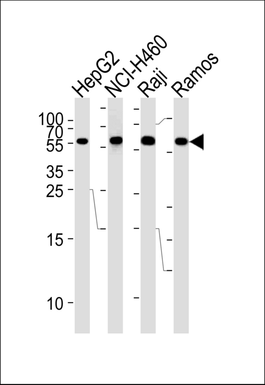 Western blot of lysates from HepG2,NCI-H460,Raji,Ramos cell line (from left to right),using MMP3 Antibody. Antibody was diluted at 1:1000 at each lane. A goat anti-rabbit IgG H&L (HRP) at 1:5000 dilution was used as the secondary antibody.Lysates at 35ug per lane.