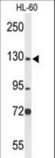 Western blot of MCM2 Antibody in HL-60 cell line lysates (35 ug/lane). MCM2 (arrow) was detected using the purified antibody.