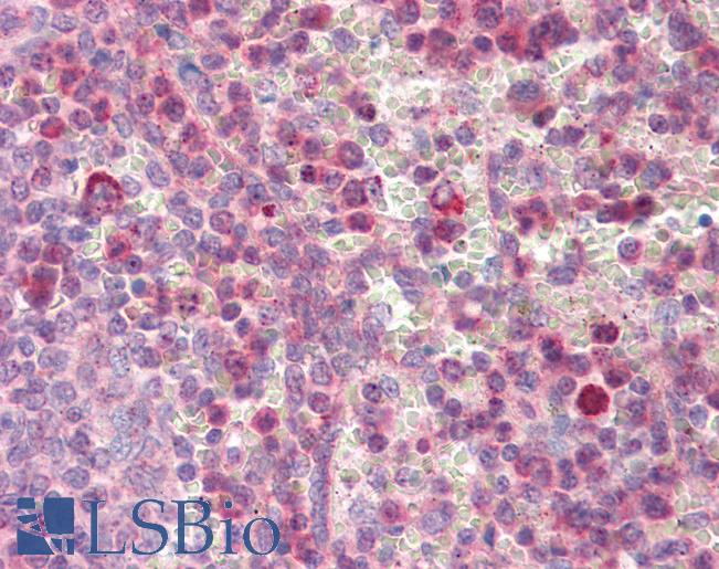 Anti-MMP-9 antibody IHC of human spleen. Immunohistochemistry of formalin-fixed, paraffin-embedded tissue after heat-induced antigen retrieval. Antibody LS-B3455 concentration 10 ug/ml.