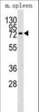Western blot of MMP9 (arrow) in mouse spleen lysates (35 ug/lane). MMP9 (arrow) was detected using the purified antibody.