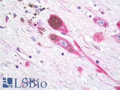 Anti-MC1R antibody IHC of brain, substantia nigra, neurons. Immunohistochemistry of formalin-fixed, paraffin-embedded tissue after heat-induced antigen retrieval. Antibody LS-A1040 dilution 5-7 ug/ml.