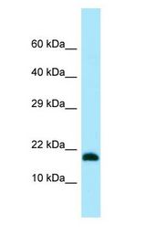 MMS2 / UBE2V2 antibody Western Blot of 721_B.