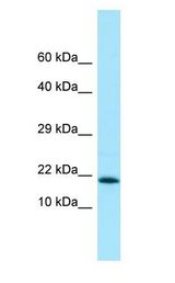 MMS2 / UBE2V2 antibody Western Blot of Fetal Heart.