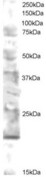 Antibody staining (0.5 ug/ml) of human brain lysate (RIPA buffer, 30 ug total protein per lane). Primary incubated for 12 hour. Detected by Western blot of chemiluminescence.