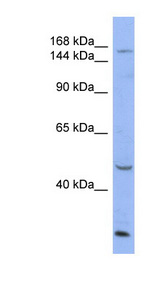 ATP7A antibody LS-C109828 Western blot of HT1080 cell lysate.