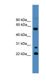 MNS1 antibody LS-C135433 Western blot of 721_B cell lysate.