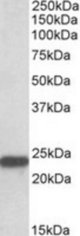 SOD2 antibody (0.1 ug/ml) staining of Mouse Spinal Cord lysate (35 ug protein/ml in RIPA buffer). Primary incubation was 1 hour. Detected by chemiluminescence.