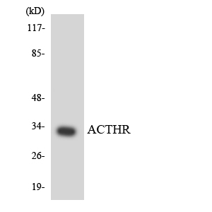 Western blot of the lysates from COLO205 cells using ACTHR antibody.