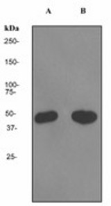 Western blot analysis on (A) Molt-4 and (B) Raji cell lysates using anti-MNX1 / HB9 (LS-C105521), dilution: 1:200000.