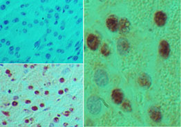 IHC of HB9 in formalin-fixed, paraffin-embedded mouse pancreas tissue using an isotype control (top left) and LS-C148679 (bottom left, right) at 5 ug/ml.