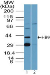 Western blot of HB9 in MOLT-4 cell lysates in the 1) absence and 2) presence of immunizing peptide using LS-C148679 at 0.5 ug/ml. Goat anti-rabbit Ig HRP secondary antibody, and PicoTect ECL substrate solution, were used for this test.