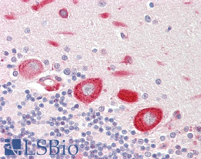 Human Brain, Cerebellum: Formalin-Fixed, Paraffin-Embedded (FFPE)