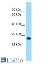 MOB1A antibody Western Blot of Human fetal heart. Antibody dilution: 1 ug/ml.