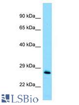 MOB1A antibody Western Blot of Jurkat. Antibody dilution: 1 ug/ml.
