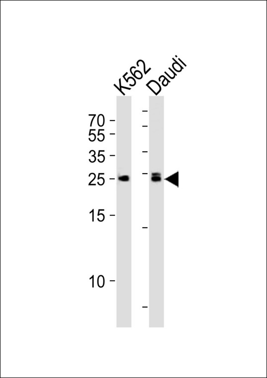 Western blot of lysates from K562, Daudi cell line (from left to right), using MOB4A Antibody. Antibody was diluted at 1:1000 at each lane. A goat anti-rabbit IgG H&L (HRP) at 1:5000 dilution was used as the secondary antibody. Lysates at 35ug per lane.