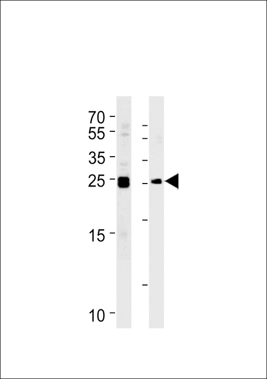 MOB4A Antibody western blot of Daudi,K562 cell line lysates (35 ug/lane). The MOB4A antibody detected the MOB4A protein (arrow).
