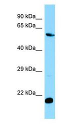 MOB1B / MOBKL1A antibody Western Blot of Jurkat.
