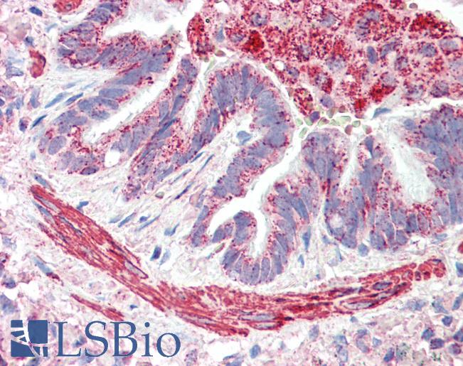 Anti-MOB2 antibody IHC staining of human lung, airway. Immunohistochemistry of formalin-fixed, paraffin-embedded tissue after heat-induced antigen retrieval. Antibody LS-B9536 concentration 5 ug/ml.