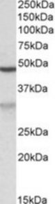 MOB2 antibody (0.02 ug/ml) staining of Jurkat lysate (35 ug protein/ml in RIPA buffer). Primary incubation was 1 hour. Detected by chemiluminescence.