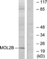 Western blot of extracts from COLO cells, using MOBKL2B Antibody. The lane on the right is treated with the synthesized peptide.
