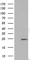 HEK293T cells were transfected with the pCMV6-ENTRY control (Left lane) or pCMV6-ENTRY MOBKL2B (Right lane) cDNA for 48 hrs and lysed. Equivalent amounts of cell lysates (5 ug per lane) were separated by SDS-PAGE and immunoblotted with anti-MOBKL2B.