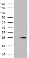 HEK293T cells were transfected with the pCMV6-ENTRY control (Left lane) or pCMV6-ENTRY MOBKL2B (Right lane) cDNA for 48 hrs and lysed. Equivalent amounts of cell lysates (5 ug per lane) were separated by SDS-PAGE and immunoblotted with anti-MOBKL2B.