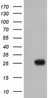 HEK293T cells were transfected with the pCMV6-ENTRY control (Left lane) or pCMV6-ENTRY MOBKL2B (Right lane) cDNA for 48 hrs and lysed. Equivalent amounts of cell lysates (5 ug per lane) were separated by SDS-PAGE and immunoblotted with anti-MOBKL2B.