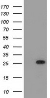 HEK293T cells were transfected with the pCMV6-ENTRY control (Left lane) or pCMV6-ENTRY MOBKL2B (Right lane) cDNA for 48 hrs and lysed. Equivalent amounts of cell lysates (5 ug per lane) were separated by SDS-PAGE and immunoblotted with anti-MOBKL2B.