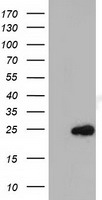 HEK293T cells were transfected with the pCMV6-ENTRY control (Left lane) or pCMV6-ENTRY MOBKL2B (Right lane) cDNA for 48 hrs and lysed. Equivalent amounts of cell lysates (5 ug per lane) were separated by SDS-PAGE and immunoblotted with anti-MOBKL2B.