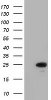 HEK293T cells were transfected with the pCMV6-ENTRY control (Left lane) or pCMV6-ENTRY MOBKL2B (Right lane) cDNA for 48 hrs and lysed. Equivalent amounts of cell lysates (5 ug per lane) were separated by SDS-PAGE and immunoblotted with anti-MOBKL2B.