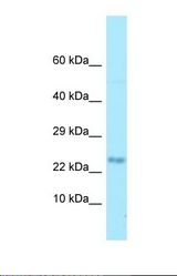 Western blot of Human HCT15. MOBP antibody dilution 1.0 ug/ml.