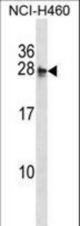 MOCS2 Antibody western blot of NCI-H460 cell line lysates (35 ug/lane). The MOCS2 antibody detected the MOCS2 protein (arrow).