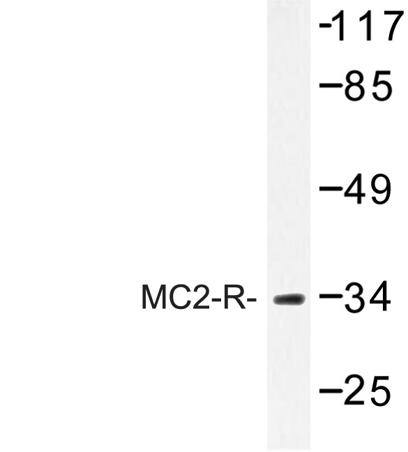 Western blot of Adenosine MC2-R (K289) pAb in extracts from HeLa cells.