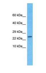Western blot of MOG1 Antibody with human Fetal Kidney lysate.
