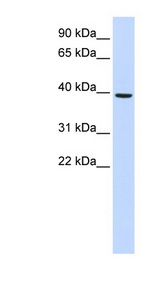 MOGAT2 antibody LS-C102348 Western blot of Fetal Liver lysate.