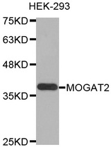 Western blot analysis of extracts of HEK-293 cell line, using MOGAT2 antibody.