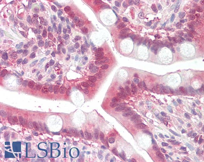 Anti-MOGAT2 antibody IHC staining of human small intestine. Immunohistochemistry of formalin-fixed, paraffin-embedded tissue after heat-induced antigen retrieval.