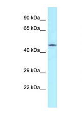 MON1A antibody LS-C145985 Western blot of Jurkat Cell lysate. Antibody concentration 1 ug/ml.