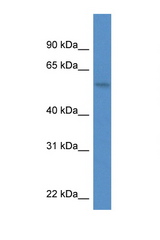 MON1A antibody LS-C135800 Western blot of PANC1 Cell lysate. Antibody concentration 1 ug/ml.