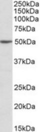 MON1A antibody (2 ug/ml) staining of Jurkat lysate (35 ug protein/ml in RIPA buffer). Primary incubation was 1 hour. Detected by chemiluminescence.