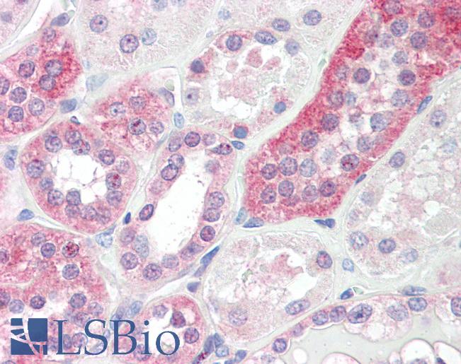 Human Kidney: Formalin-Fixed, Paraffin-Embedded (FFPE)