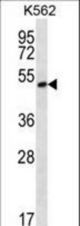 MORN1 Antibody western blot of K562 cell line lysates (35 ug/lane). The MORN1 antibody detected the MORN1 protein (arrow).