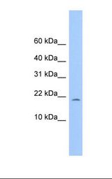 721_B cell lysate. Antibody concentration: 1.0 ug/ml. Gel concentration: 10-20%.