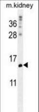 MORN5 Antibody western blot of mouse kidney tissue lysates (35 ug/lane). The MORN5 antibody detected the MORN5 protein (arrow).