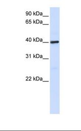 Placenta lysate. Antibody concentration: 1.0 ug/ml. Gel concentration: 12%.