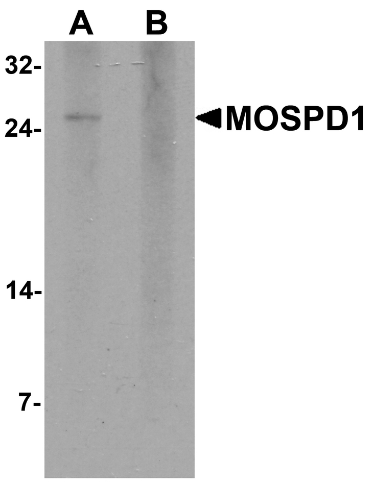 Western blot analysis of MOSPD1 in human brain tissue lysate with MOSPD1 antibody at 1 ug/ml in (A) the absence and (B) the presence of blocking peptide.