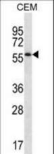 MOSPD2 Antibody (N-term ) western blot of CEM cell line lysates (35 ug/lane). The MOSPD2 antibody detected the MOSPD2 protein (arrow).